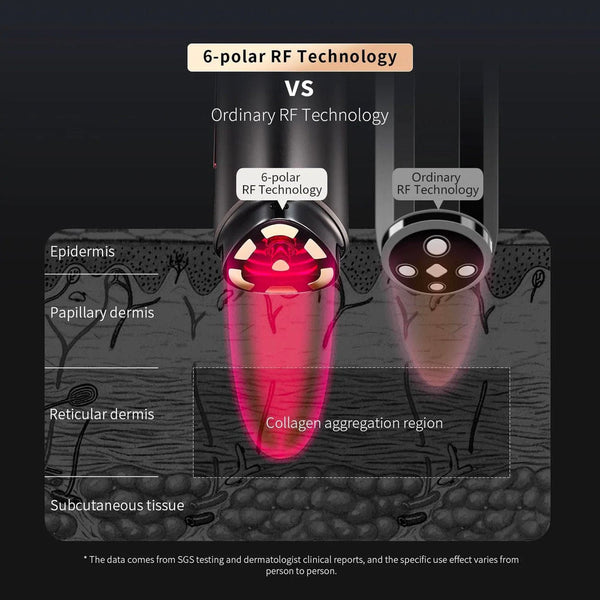 AMIRO R1 PRO Facial RF Skin Tightening Device