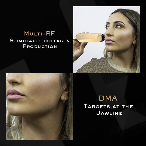 Tripollar Stop Vx Gold technology